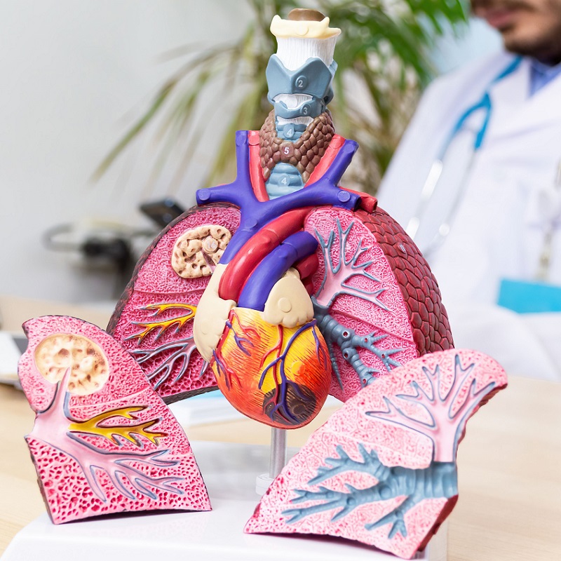 Lungenkrankheiten Lungenkrankheiten